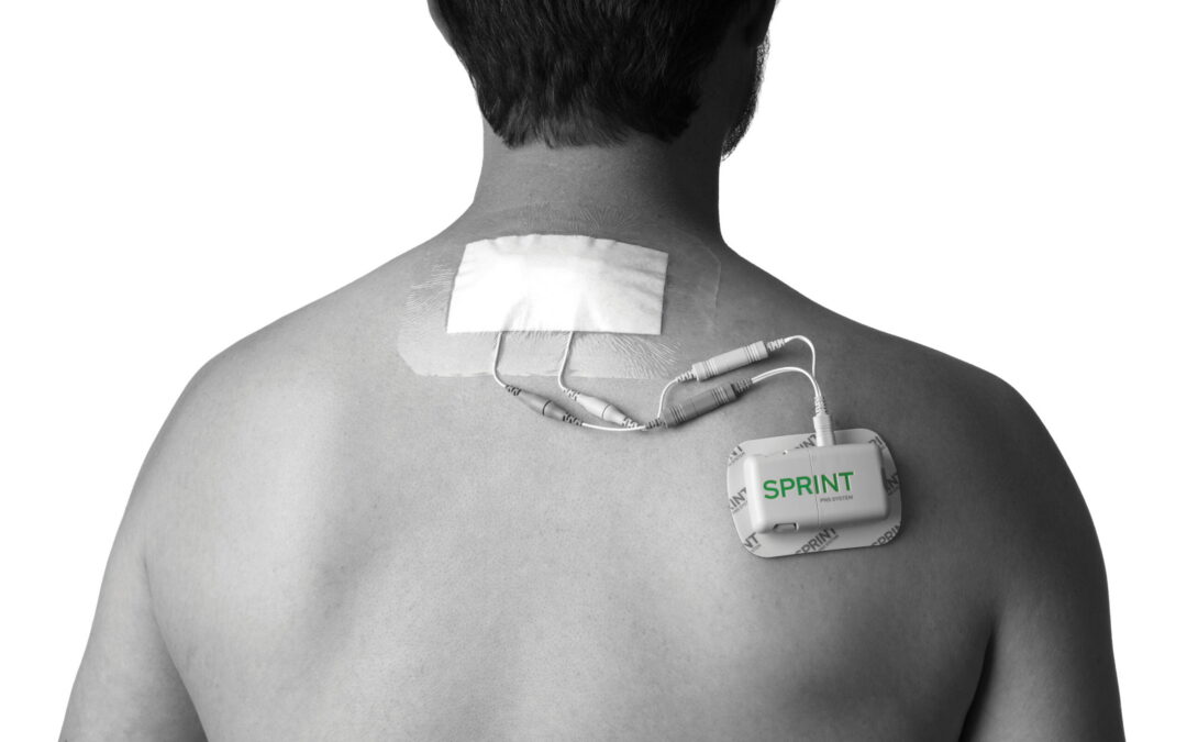 Sprint PNS System